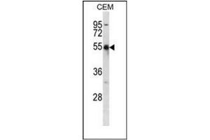 Western blot analysis of KCNA2 Antibody (C-term) in CEM cell line lysates (35ug/lane). (KCNA2 Antikörper  (C-Term))