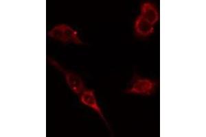 ABIN6276430 staining HepG2 cells by IF/ICC. (WASP Antikörper  (Internal Region))