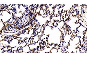 Detection of TM in Rat Lung Tissue using Polyclonal Antibody to Thrombomodulin (TM) (Thrombomodulin Antikörper  (AA 31-167))
