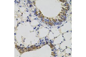 Immunohistochemistry of paraffin-embedded mouse lung using CD59 antibody (ABIN3212238) (40x lens). (CD59 Antikörper)