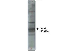 Image no. 1 for anti-Calcium Channel, Voltage-Dependent, beta 4 Subunit (CACNB4) antibody (ABIN265039) (CACNB4 Antikörper)