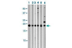 Western blot analysis of Lane 1: 293 cell lysates, Lane 2: Ramos cell lysates, Lane 3: HeLa cell lysates, Lane 4: HepG2 cell lysates, Lane 5: T47D cell lysates, Lane 6: Jurkat cell lysates with MAP1LC3C polyclonal antibody  at 1:1000 dilution. (LC3C Antikörper  (AA 1-30))