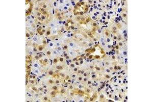 Immunohistochemical analysis of HIWI2 staining in rat kidney formalin fixed paraffin embedded tissue section.