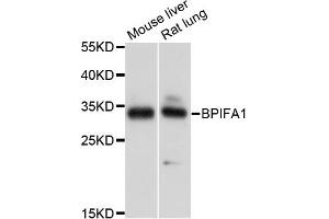 Western blot analysis of extracts of various cell lines, using BPIFA1 antibody. (BPIFA1 Antikörper)