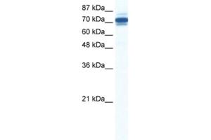 Western Blotting (WB) image for anti-Zinc Finger and SCAN Domain Containing 29 (ZSCAN29) antibody (ABIN2461307) (ZSCAN29 Antikörper)