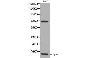 Western blot analysis of mouse brain cell lysate using IFNG antibody. (Interferon gamma Antikörper)