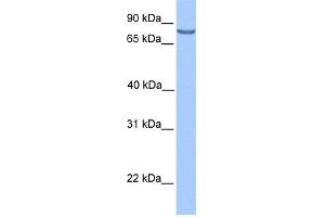 WB Suggested Anti-LCA5 Antibody Titration: 0. (LCA5 Antikörper  (N-Term))