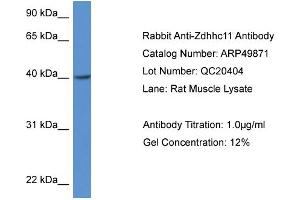 Western Blotting (WB) image for anti-Zinc Finger, DHHC-Type Containing 11 (ZDHHC11) (Middle Region) antibody (ABIN2783945) (ZDHHC11 Antikörper  (Middle Region))