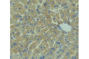 Immunohistochemistry (IHC) image for anti-Prostaglandin F2 Receptor Negative Regulator (PTGFRN) (AA 22-263) antibody (ABIN5014168)