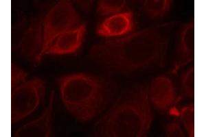 Immunofluorescence staining of methanol-fixed MCF7 cells using Her3/ErbB3(phospho-Tyr1328) Antibody. (ERBB3 Antikörper  (pTyr1328))