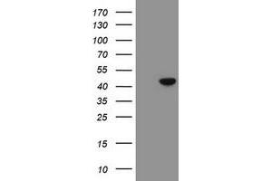 Image no. 2 for anti-Chromobox Homolog 8 (CBX8) (AA 1-260) antibody (ABIN1490661)