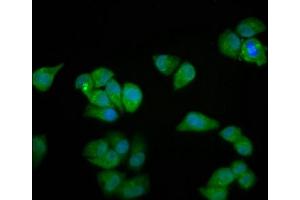 Immunofluorescence staining of Hela cells with ABIN7160664 at 1:100, counter-stained with DAPI. (MYOZ2 Antikörper  (AA 90-180))