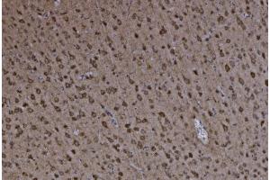 IHC analysis of FABP-1/GOT2 using anti-FABP-1/GOT2 antibody (ABIN7601426). (GOT2 Antikörper  (AA 35-430))
