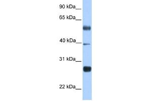 WB Suggested Anti-MXD3 Antibody Titration:  0.