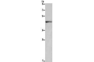 Western Blotting (WB) image for anti-Interleukin 5 Receptor, alpha (IL5RA) antibody (ABIN2433197) (IL5RA Antikörper)