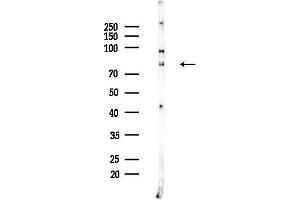 Western blot analysis of lysates from EC304 cells, using B Antibody at 1/1000 dilution.