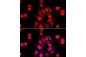 Immunofluorescence analysis of HeLa cells using RBFOX3 antibody (ABIN1874561) at dilution of 1:100. (NeuN Antikörper)