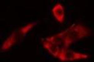 Immunofluorescence (fixed cells) (IF/ICC) image for anti-HECT, C2 and WW Domain Containing E3 Ubiquitin Protein Ligase 2 (HECW2) (Internal Region) antibody (ABIN6257169)