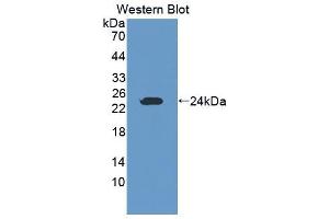 Western blot analysis of the recombinant protein. (GZMK Antikörper  (AA 44-227))