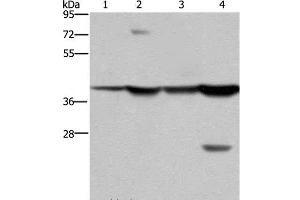 Western Blot analysis of Mouse stomach and Human fetal liver tissue, MCF-7 cell and Mouse liver tissue using FBP1 Polyclonal Antibody at dilution of 1:850 (FBP1 Antikörper)