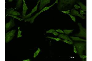 Immunofluorescence of monoclonal antibody to TNFRSF21 on HeLa cell. (TNFRSF21 Antikörper  (AA 1-472))