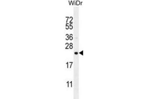 Western Blotting (WB) image for anti-Family with Sequence Similarity 237 Member A (FAM237A) antibody (ABIN3004576) (FAM237A Antikörper)