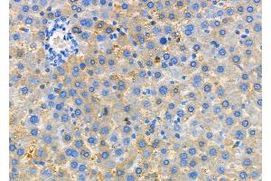 ABIN6260061 and ABIN6279142 at 1/100 staining Rat liver tissue by IHC-P. (Arylsulfatase H Antikörper  (C-Term))