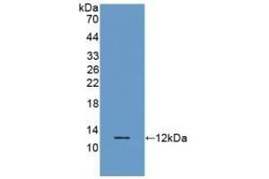 Detection of Recombinant RANTES, Porcine using Polyclonal Antibody to Regulated On Activation In Normal T-Cell Expressed And Secreted (RANTES) (CCL5 Antikörper  (AA 24-91))