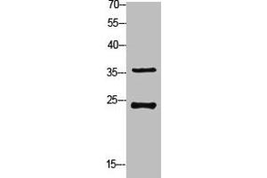 Western Blot analysis of customer's (cat sample) using Ribosomal Protein S4X Polyclonal Antibody (RPS4X Antikörper  (Internal Region))