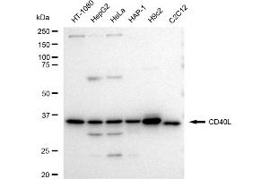 Western blotting analysis using CD40L antibody (ABIN7797971).