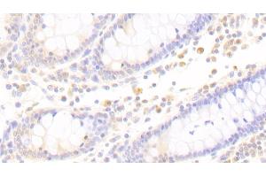 Detection of APBB1IP in Human Colon Tissue using Polyclonal Antibody to Amyloid Beta Precursor Protein Binding B1 Interacting Protein (APBB1IP) (Amyloid beta (A4) Precursor Protein-Binding, Family B, Member 1 Interacting Protein (APBB1IP) (AA 188-421) Antikörper)
