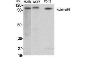 Western Blot (WB) analysis of specific cells using Actinin-alpha2/3 Polyclonal Antibody. (ACTN2/3 Antikörper  (N-Term))