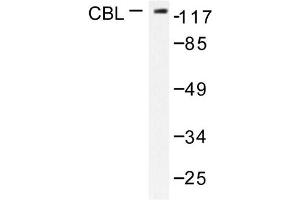 Image no. 1 for anti-Cas-Br-M (Murine) Ecotropic Retroviral Transforming Sequence (CBL) antibody (ABIN271926) (CBL Antikörper)