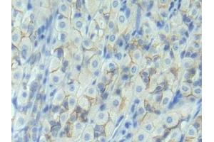 Immunohistochemistry (IHC) image for anti-Cadherin 1, Type 1, E-Cadherin (Epithelial) (CDH1) (AA 155-266) antibody (ABIN7430414)