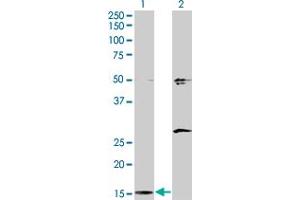 Western Blot analysis of AP2S1 expression in transfected 293T cell line by AP2S1 monoclonal antibody (M01), clone 3E4. (AP2S1 Antikörper  (AA 1-142))