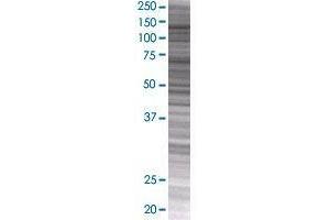 Western Blotting (WB) image for NCKAP1 293T Cell Transient Overexpression Lysate(Denatured) (ABIN1335158)