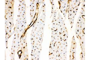 Anti- Annexin A3 Picoband antibody, IHC(P) IHC(P): Rat Cardiac Muscle Tissue (Annexin A3 Antikörper  (Middle Region))