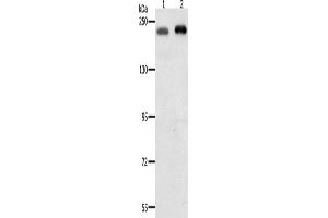 Western Blotting (WB) image for anti-SWI/SNF Related, Matrix Associated, Actin Dependent Regulator of Chromatin, Subfamily A, Member 4 (SMARCA4) antibody (ABIN2431118) (SMARCA4 Antikörper)