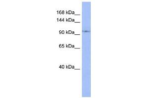 WB Suggested Anti-DDX26B Antibody Titration:  0.