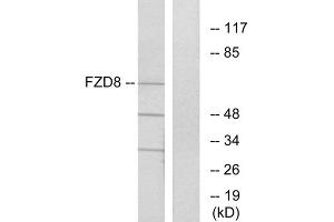 Western blot analysis of extracts from Jurkat cells, using FZD8 antibody. (FZD8 Antikörper  (C-Term))