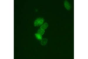 Immunofluorescence (IF) image for anti-Small Ubiquitin Related Modifier Protein 1 (SUMO1) (full length) antibody (ABIN2452138) (SUMO1 Antikörper  (full length))
