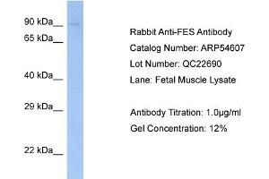 Western Blotting (WB) image for anti-Feline Sarcoma Oncogene (FES) (N-Term) antibody (ABIN2785795) (FES Antikörper  (N-Term))