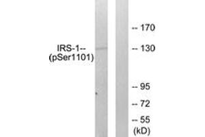 Western blot analysis of extracts from COS7 cells treated with Calyculin A 50ng/ml 30', using IRS-1 (Phospho-Ser1101) Antibody. (IRS1 Antikörper  (pSer1101))