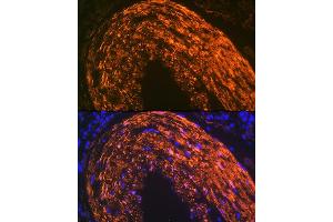 Immunofluorescence analysis of mouse large intestine using Calponin Rabbit mAb (ABIN1678670, ABIN3018018, ABIN3018019 and ABIN7101568) at dilution of 1:100 (40x lens). (CNN1 Antikörper)