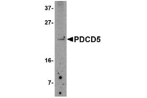 Image no. 1 for anti-Programmed Cell Death 5 (PDCD5) (N-Term) antibody (ABIN341739) (PDCD5 Antikörper  (N-Term))