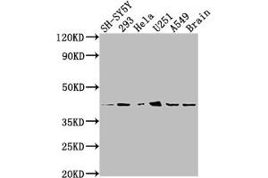 Western Blot Positive WB detected in: SH-SY5Y whole cell lysate, 293 whole cell lysate, Hela whole cell lysate, U251 whole cell lysate, A549 whole cell lysate, Mouse brain tissue All lanes: OPRD1 antibody at 1:2000 Secondary Goat polyclonal to rabbit IgG at 1/50000 dilution Predicted band size: 41 kDa Observed band size: 41 kDa (Rekombinanter OPRD1 Antikörper)