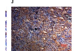 Immunofluorescence (Paraffin-embedded Sections) (IF (p)) image for anti-Secreted Protein, Acidic, Cysteine-Rich (Osteonectin) (SPARC) (AA 101-200) antibody (ABIN738141)