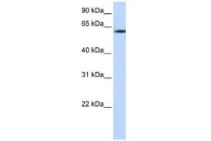 FBXO24 antibody used at 1 ug/ml to detect target protein. (FBXO24 Antikörper  (N-Term))