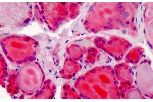 Human Thyroid: Formalin-Fixed, Paraffin-Embedded (FFPE) (XPO1 Antikörper  (AA 390-408))