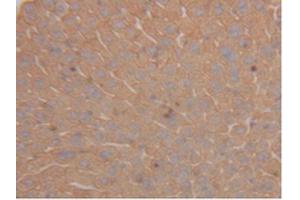 IHC-P analysis of Mouse Liver Tissue, with DAB staining. (Cytokeratin 18 Antikörper  (AA 1-423))